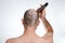 The concept of baldness and alopecia. A man holds a hair clipper and shaves the hair on top of his head. The view from the back.