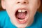 The concept of growth and loss of baby teeth in children. Close-up of a Caucasian boy opened his mouth wide for a checkup at the d