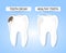 The concept of healthy and diseased tooth
