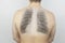 Conceptual photo. X-ray of a man from the back. An image of the ribs and lungs appeared on the skin of the patient back. View of