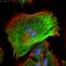 Confocal microscopy of fibroblast cells