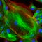 Confocal microscopy of fibroblast cells