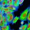 Confocal microscopy of fibroblast cells