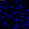 Confocal microscopy of fibroblasts nuclei