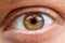 Conjunctivitis. Macro. The inflamed eye