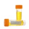 Containers with urine samples on white background, space for text.