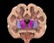 Coronal section of a healthy brain showing normal anatomy of basal baglia and ventricles
