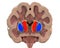 Coronal section of a healthy brain showing normal anatomy of basal baglia and ventricles