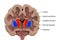 Coronal section of a healthy brain showing normal anatomy of basal baglia and ventricles