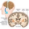 Coronal section of the human brain medical  illustration