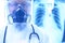 Coronavirus or covid-19 concept,Male doctor in a protective suit Giving medicines to patients in the hospital.Lung X-ray Film Dest