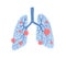 Coronavirus damaged human lungs, pandemic covid-19