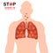 Coronavirus disease COVID-19 infection medical illustration. China pathogen respiratory influenza covid virus cells. Body heat