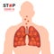 Coronavirus disease COVID-19 infection medical illustration. China pathogen respiratory influenza covid virus cells. Body heat