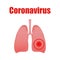 Coronavirus  poster