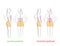 Correct and incorrect posture. side and rear view. medical recommendations. vector illustration.