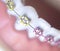 Cosmetic dental metal brackets