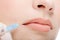 Cosmetic injection in the female lips