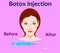 Cosmetic surgery vector illustration. Botox injection. facial wrinkle treatment.