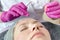 Cosmetologist applies hyaluronic acid to patient`s face for a rejuvenating procedure