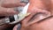 Cosmetologist doctor making multiple injections biorevitalization in woman face skin under eye, closeup shot