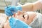 Cosmetologist doing mechanical face peeling treatment