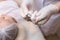 Cosmetologist holds a sterile bag with a needle in front of the client thus showing him the process of removing it from the