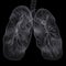 Covid-19 Computed Tomography Of The Lungs. CT Scan