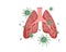 Covid-19 corona virus or 2019-ncov virus affects lung damage. Virus or bacterial infects lungs.virus invades lungs