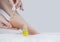 Cracked heels. Woman feet before and after procedures to soften rough skin. Urea cream, oil for care of keratinized skin, healing