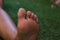 Cracking toes health care and medical problems concept soft focus picture of female child feet