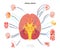 Cranial nerves diagram