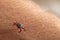 Crawling deer tick on the background of human hairy skin. Dangerous insect infects with disease