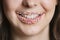 Cropped portrait of Middle Eastern woman with sprinkle candy lips