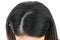 Cropped view of woman top`s head with part of her thin hair, she had hair loss problem.