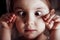 cross eyed squinting expression little girl. Squinting closeup. Strabismus in children causes and treatment concept