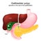 Cross section of a Gallbladder with polyps