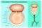 Cross section of the trachea and esophagus.