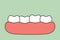 Crowding teeth malocclusion, dental problem
