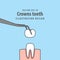 Crown teeth illustration vector on blue background. Dental