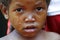 Crying girl with tear on cheek - poor african child