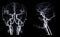 CT angiography of the brain or CTA brain showing Cerebral aryery