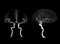 CT angiography of the brain or CTA brain showing Cerebral aryery