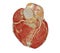 CT Cardiac 3D or CTA coronary artery.Clipping path