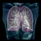 CT Chest or Lung 3D rendering image on blurred human body background .