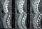 CT of Lumbar Spine