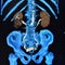Ct scan 3d ct urography kidneys bladder colorful