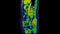 CT scan of  Abdomen  sagittal view with injection contrast media with green color mode coronal view for diagnosis  abdominal