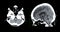 CT scan of the brain sagittal view  for diagnosis brain tumor,stroke diseases and vascular diseases