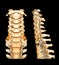 CT SCAN of Cervical Spine C-spine